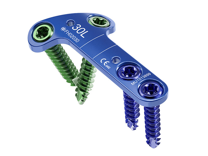 MetaFix™ I